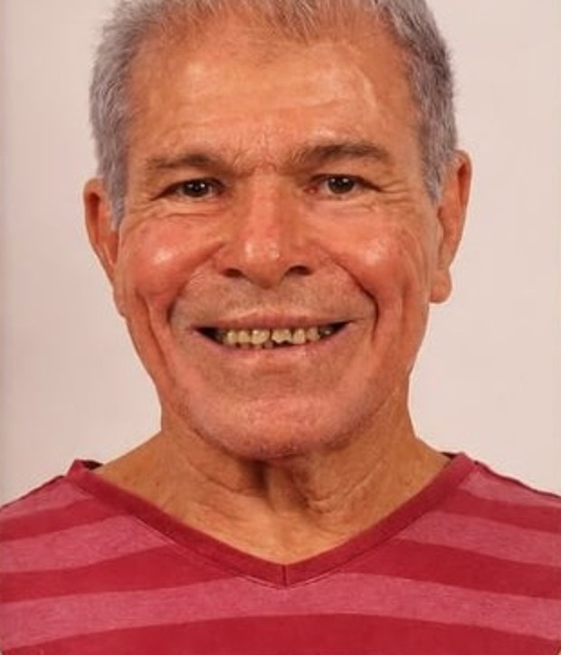 Sorriso antes da reabilitação oral